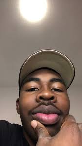 Eren Azadi Blauer Auge