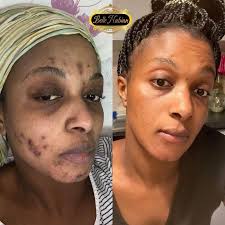 Few quality ingredients can make effective products