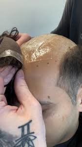 Exploring Hair Replacement Solutions with @Steevindoeshair