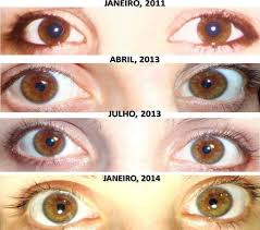 Coming Soon Biokinesis Antes E Depois Olhos Naturais Cores