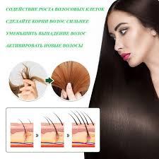 Ginger Hair Nutritional Solution Ginger King Ginger Hair Liquid Old Ginger  King Hair Care Oil Buy cheaply