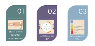 Die Medical Hair Company Mochte Es Seinen Kunden Immer So Einfach Bezahlbar Und Qualitativ Hochwertig Gestalten Haartransplantation Behandlung Hautbehandlung