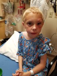 Jamison's impressive recovery and all-star selection