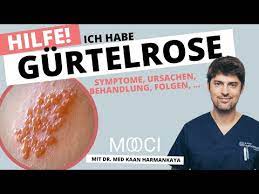 Gurtelrose Ansteckung Symptome Behandlung Mooci