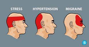 Home headache & migraine centertopic. How To Get Ride Of A Headache In 5 Minutes Without Pills