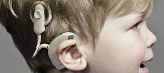 Cochlear Implants Market Report Overview 2020 Industry Size Global Growth Analysis Business Insight Share Top Company Profile Strategy Profiling Regional Revenue Medgadget