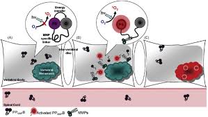 Image result for Porfimer