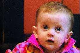 Sligo babys fight for life against the odds