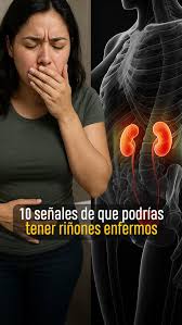10 señales de que podrías tener riñones enfermos | @paocastillooficial