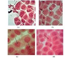 Image result for Hippocratea africana