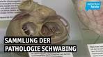 Ein medizinhistorisches Museum für München: die Sammlung ... - YouTube
