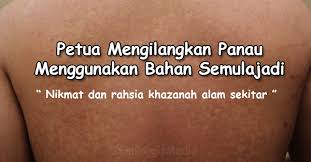 Jika anda menderita panu di kulit kepala, cara mengobati panu di kulit kepala yang topisel menjadi obat panu paling cepat untuk mengatasi masalah panu di kulit kepala. 10 Petua Hilangkan Panau Dengan Berkesan Menggunkan Bahan Semulajadi Kartel Dakwah