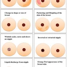 The skin might look like orange peel or the texture might feel different. The Physical Changes Of Breast Download Scientific Diagram