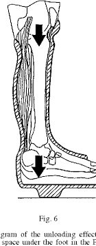 In this video, the application of a patella (or knee) tendon bearing (ptb) cast is shown. Pdf The Effect Of The Patellar Tendon Bearing Cast On Loading Semantic Scholar