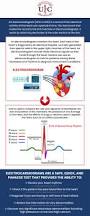 Image result for Electrocardiogram