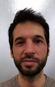 Bell's palsy comes on quickly, but typically only lasts a few weeks. Bell S Palsy Following Covid 19 Vaccination Springerlink