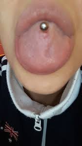 Zungenpiercing Entzundung Geht Nicht Weg Piercing Heilung