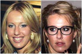 Plastika Sobchak Lena Miro Ru Livejournal