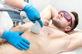 Laser hair removal is a popular method a man should consider when it comes to permanent hair removal. Man On The Procedure Of Laser Hair Removal In The Beauty Salon Stock Photo Picture And Royalty Free Image Image 110530694