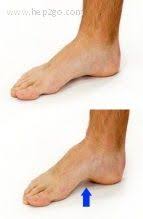 Foot Arch Lift Exercise To Strengthen The Intrinsic Muscles Of The Foot Ankle Strengthening Exercises Plantar Fasciitis Exercises Foot Exercises