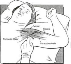 Pin On Intercostal Neuralgia