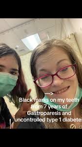 dentist #dental #dentalwork #teeth #chippedtooth #gastroparesiswarrio...