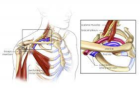 Thoracic Outlet Syndrome Goodman Campbell