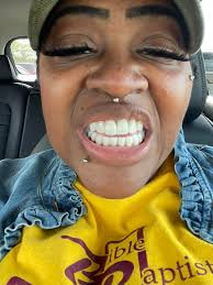 Final results of smile makeover in Sarasota, FL