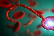 Maybe you would like to learn more about one of these? Ebola Simptome Cauze Tratament Si Preventie