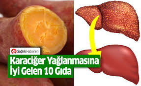 Karaciger Yaglanmasinin Nedenleri Belirtileri Ve Tedavisi Detoks Diyeti Yemek Tarifleri Gida