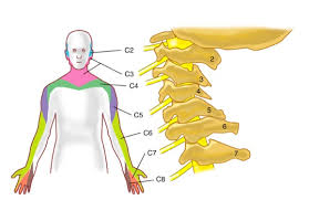 Diagnostic rare, évoqué plutôt devant une névralgie au bras sans cervicalgies + signes vasculaires. Nevralgie Cervicale Nevralgie Cervico Brachiale Symptomes Causes Diagnostic Et Traitement Clinique Chiropratique Sillery Chiro A Ste Foy Quebecclinique Chiropratique Sillery Chiro A Ste Foy Quebec