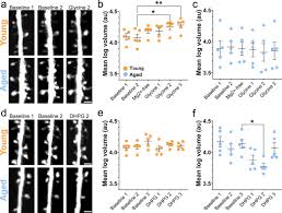 Dendritic Spines of Layer 5 Pyramidal Neurons of the Aging Somatosensory  Cortex Exhibit Reduced Volumetric Remodeling