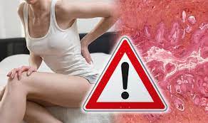 When present, common symptoms of cancer that develops in the cervix may include vaginal bleeding, including bleeding once the cancer is more advanced, women may start to notice the following warning signs of cervical cancer: Cervical Cancer Signs Severe Pain In Your Back Or Side Could Be Advanced Form Of Disease Express Co Uk