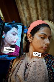 You don't have to be happy to smile.” —Daniel Willey #dermatologist  #DermatologyCare #glowingskin #pujospecial