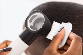 How is alopecia areata diagnosed?