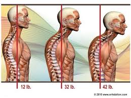 For Every Inch Of Forward Head Posture It Can Increase The Weight Of The Head On The Spine By An A Forward Head Posture Foam Roller Exercises Massage Therapy