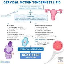 Image result for Friable Cervix