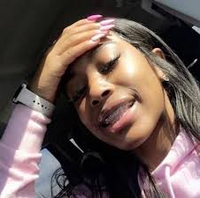 Skin Brown Girls With Braces 17 Trendy Ideas Braces And Glasses Cute Braces Brace Face