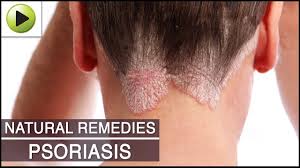Skin Care Psoriasis Natural Ayurvedic Home Remedies Youtube