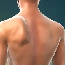 Image result for Winged Scapula