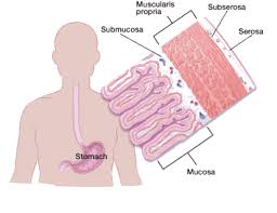 Malignant tumors of the stomach in the early stages are rarely detected and, perhaps, by accident. What Is Stomach Cancer Types Of Stomach Gastric Cancer