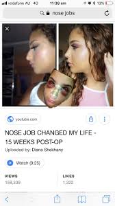 Pin By Bivibody On Alles Nose Contouring Nose Job Perfect Nose