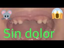 Como Sacar Un Diente De Leche Tecnica Rapida Para Extraer Un Diente Sacar Un Diente Sin Dolor Youtube