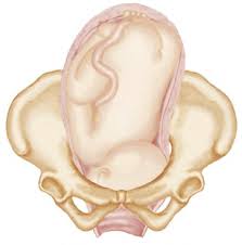 Image result for Shoulder Presentation