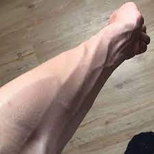 Adern Am Arm Krass Sichtbar Gesundheit Und Medizin Sport Und Fitness