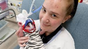 Royal Brisbane and Women's Hospital: Premature baby survives being born 16  weeks early