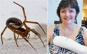 Spider bites can look very different. Woman Nearly Lost Arm After Black Widow Spider Bite