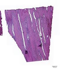 Image result for Dalbergia boehmii