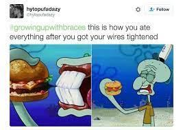 Whenever You D Leave An Orthodontist Appointment And Forget That You Probably Weren T Going To Eat Solid Foods For A Few Hours Braces Humor Cute Braces Braces Meme