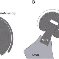 Layer of rods and cones. Pdf The Chemical Form Of Metal Species Released From Corroded Taper Junctions Of Hip Implants Synchrotron Analysis Of Patient Tissue